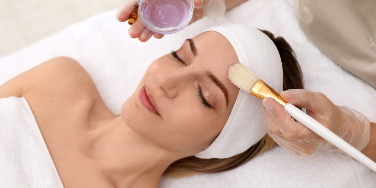 Everything You Need to Know About Chemical Peels in Islamabad