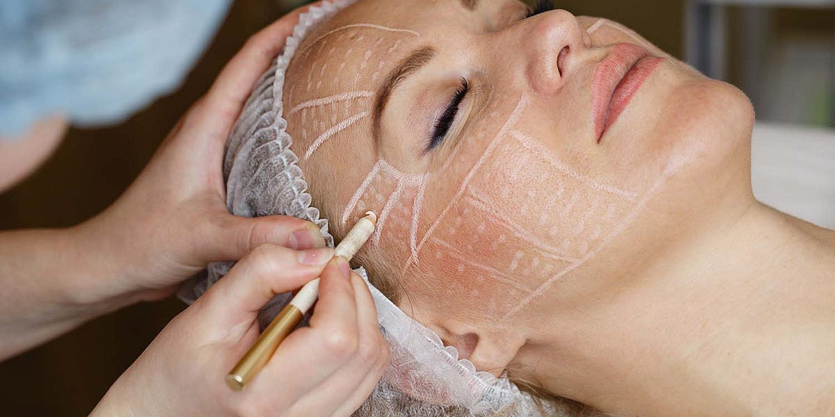 When Can I Wash My Hair After a Thread Lift?