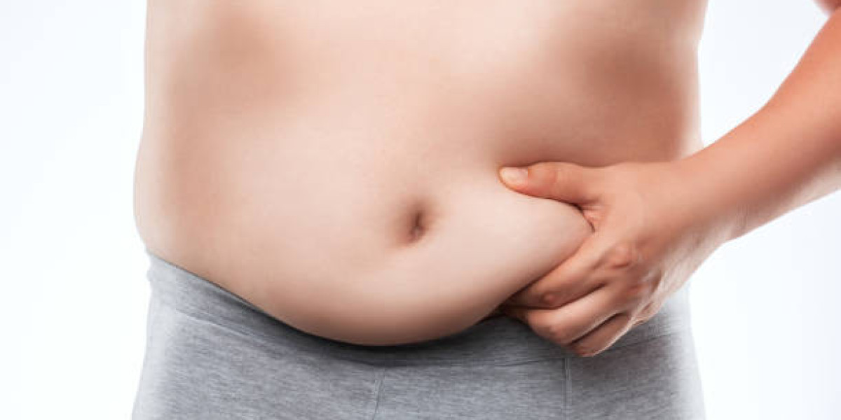 Expert Gynecomastia Surgeons in Riyadh: Top Recommendations
