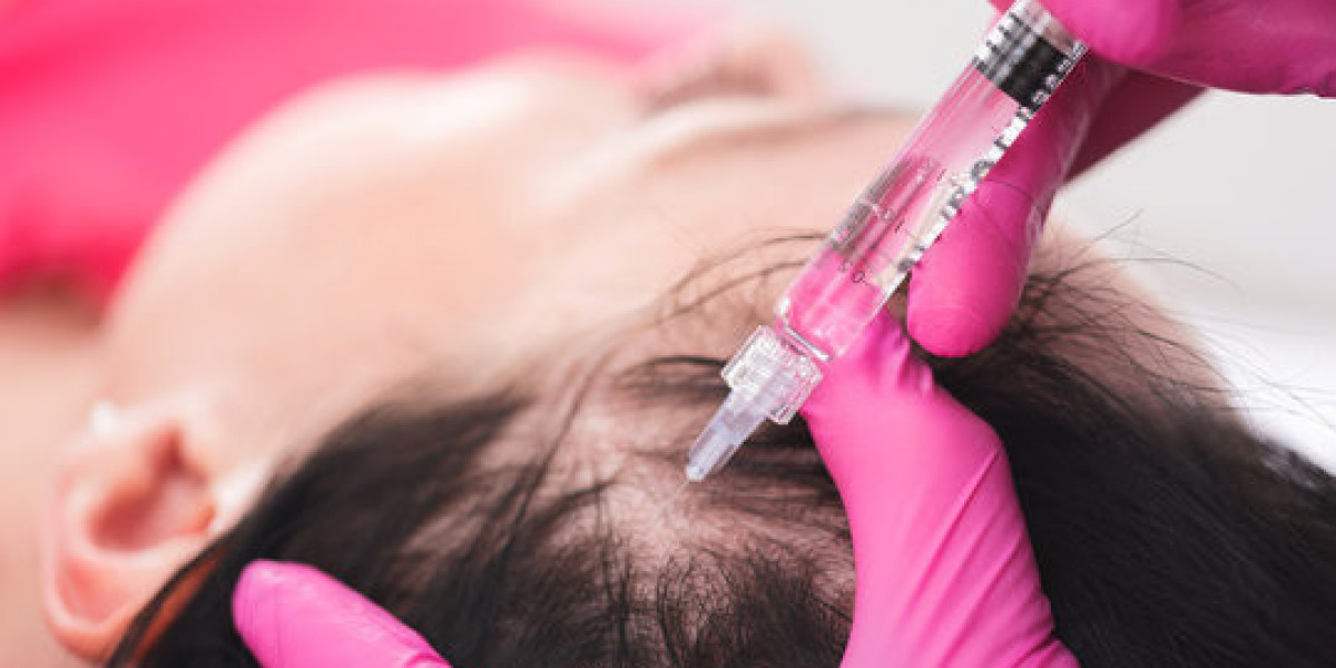 PRP Hair Treatment in Islamabad: Effective Solution for Hereditary Baldness