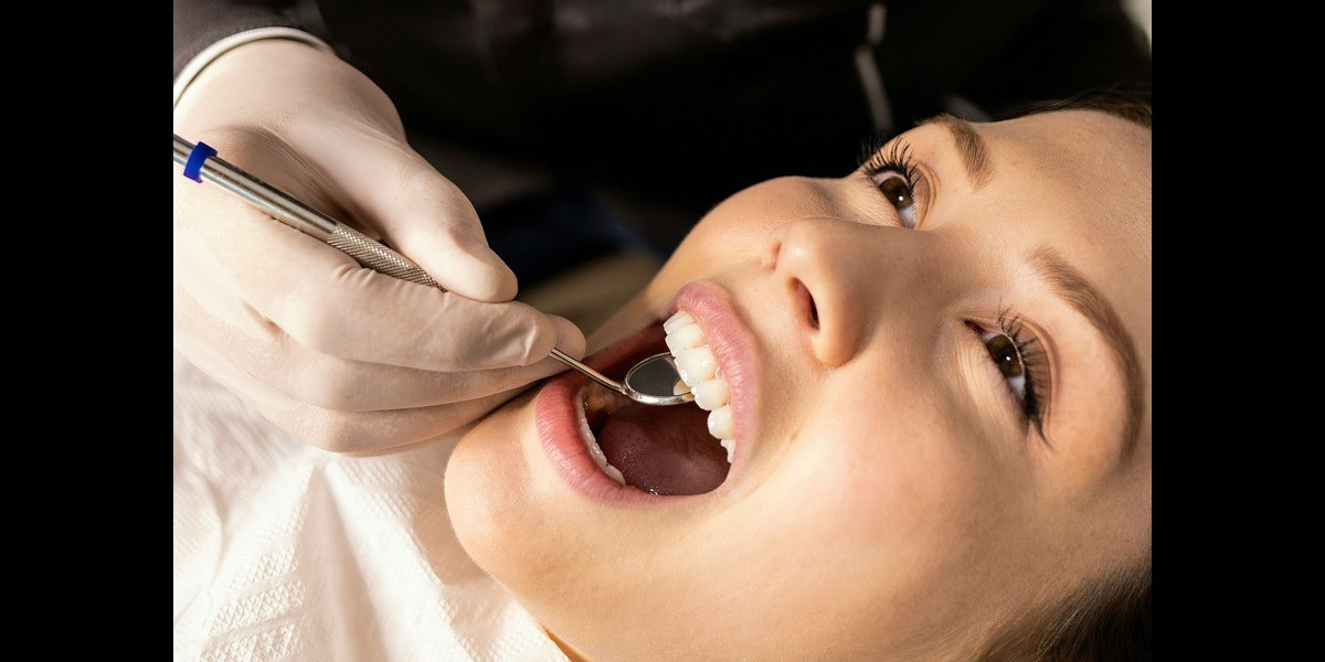 Why More People Are Choosing Dental Work in Mexico: Affordable, Safe, and High-Quality Care