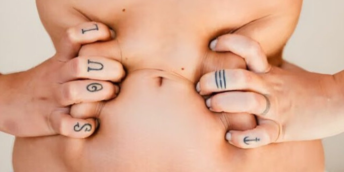 How Much Does a Tummy Tuck Cost in Islamabad?