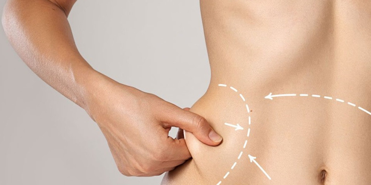 Foods That Aid Recovery After Liposuction in Islamabad