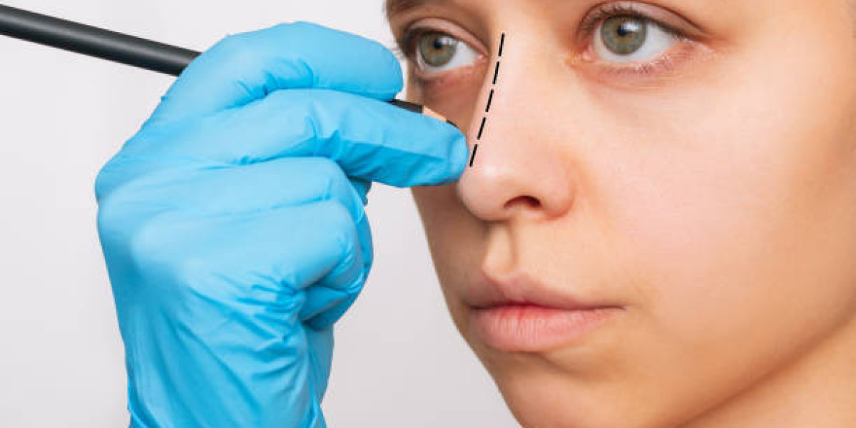 هل عملية تجميل الأنف في الرياض آمنة؟