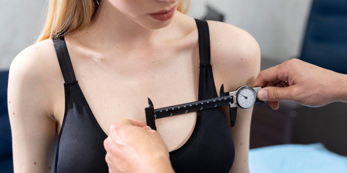 Breast Augmentation Recovery: Essential Tips