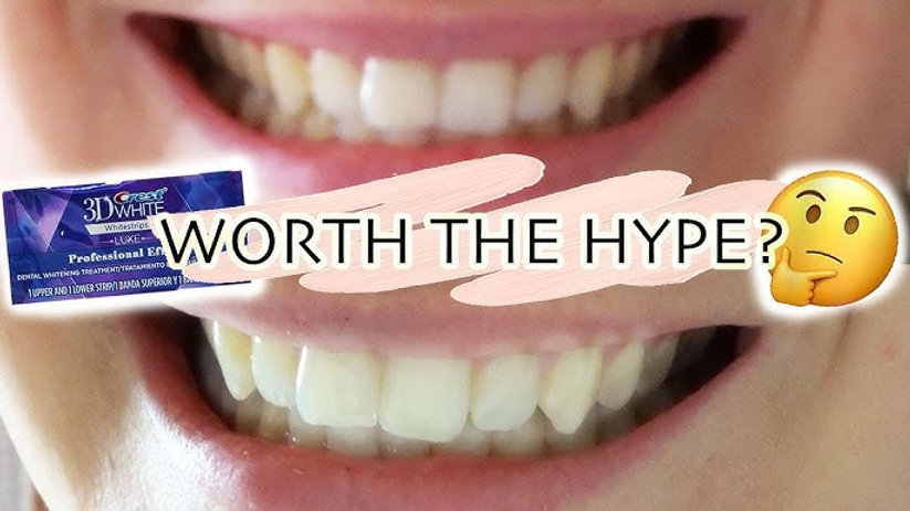Crest Whitening Strips: Fast, Safe, and Effective Whitening