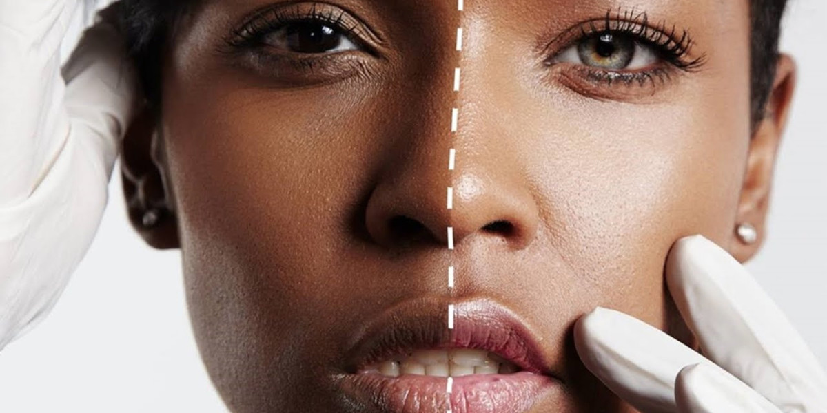 Is Skin Whitening Halal? Islamic View for Islamabad Residents
