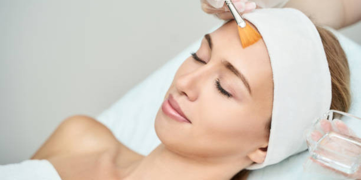 Chemical Peels in Islamabad: Transform Your Skin Safely