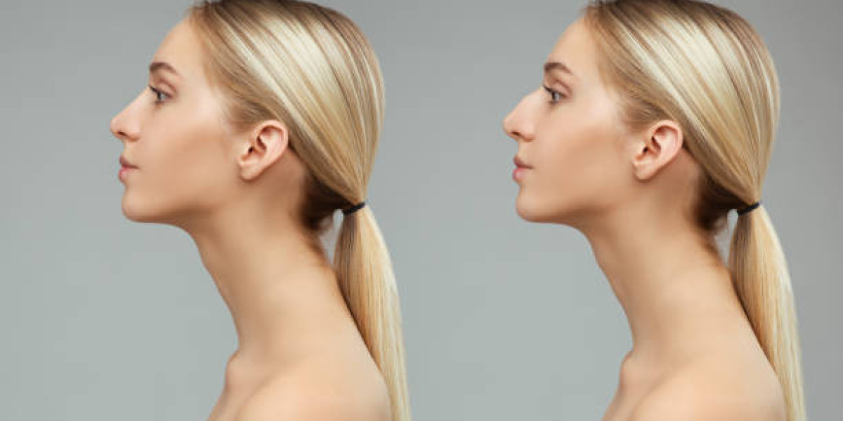 أحدث التقنيات في عملية تجميل الأنف في الرياض