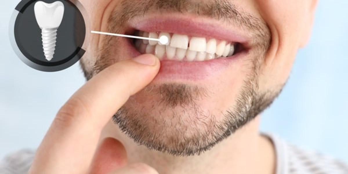 What to Eat and Avoid After Getting Dental Implants