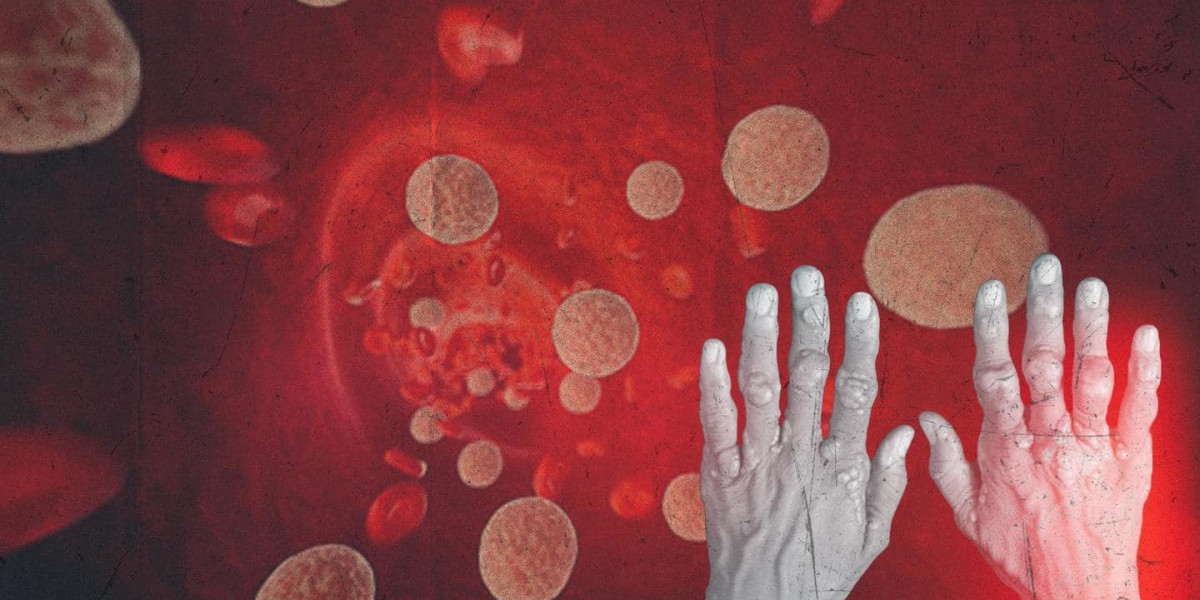 Hypercholesterolemia Market Growth Dynamics and Strategic Outlook 2025-2032