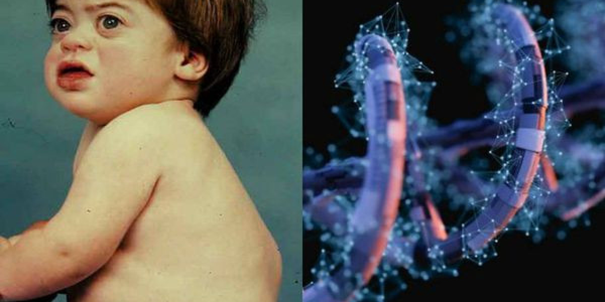 Sanfilippo Syndrome Market Growth and Strategic Outlook 2025-2032