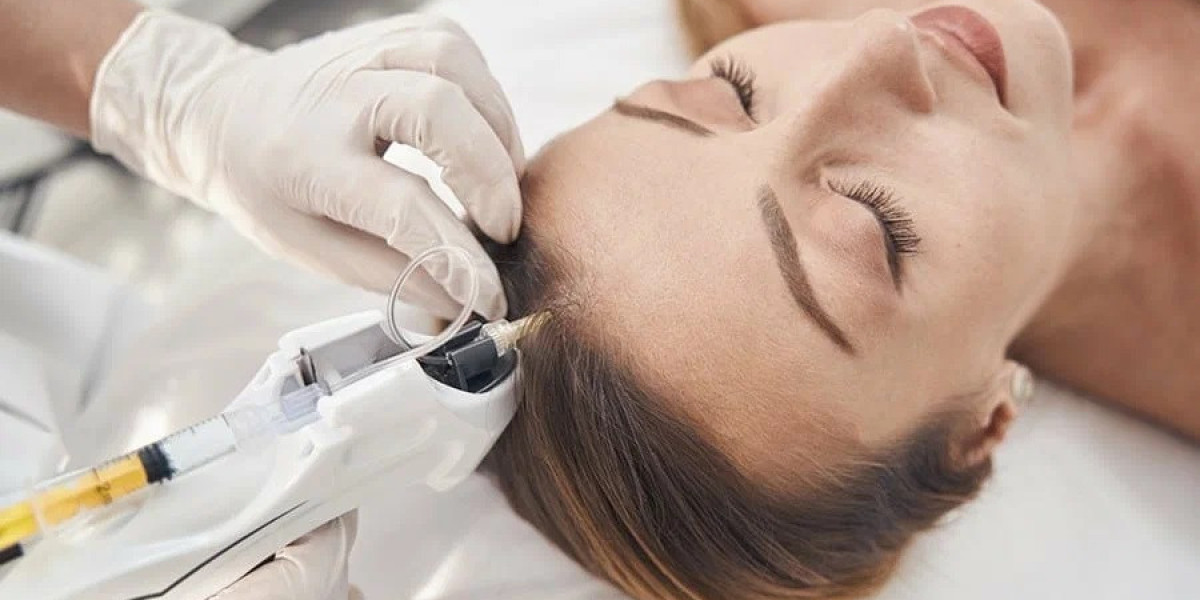 Mesotherapy in Islamabad: Step-by-Step Procedure Guide