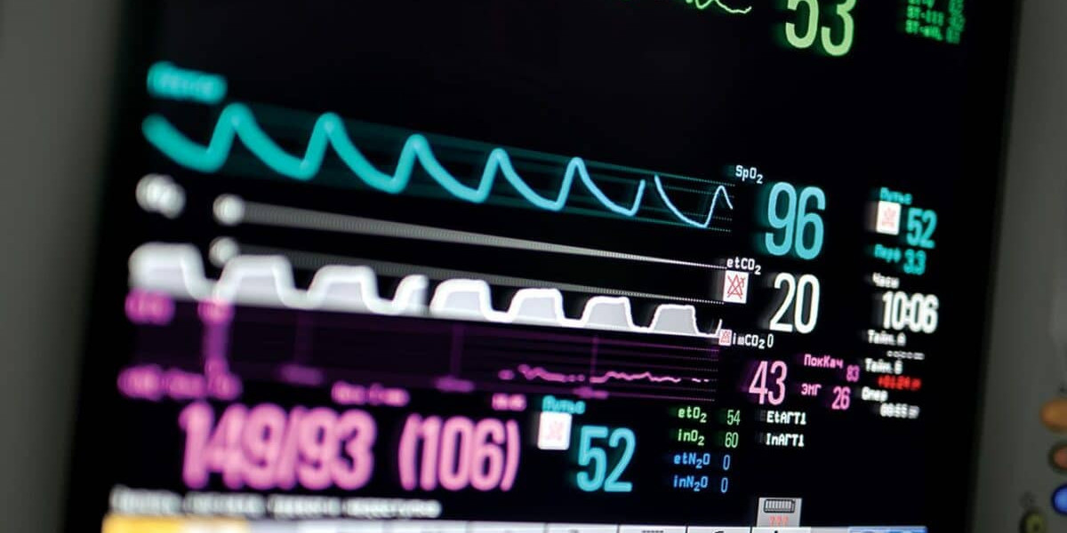 Capnography Equipment Market Size, Trends, and Strategic Outlook 2025-2032