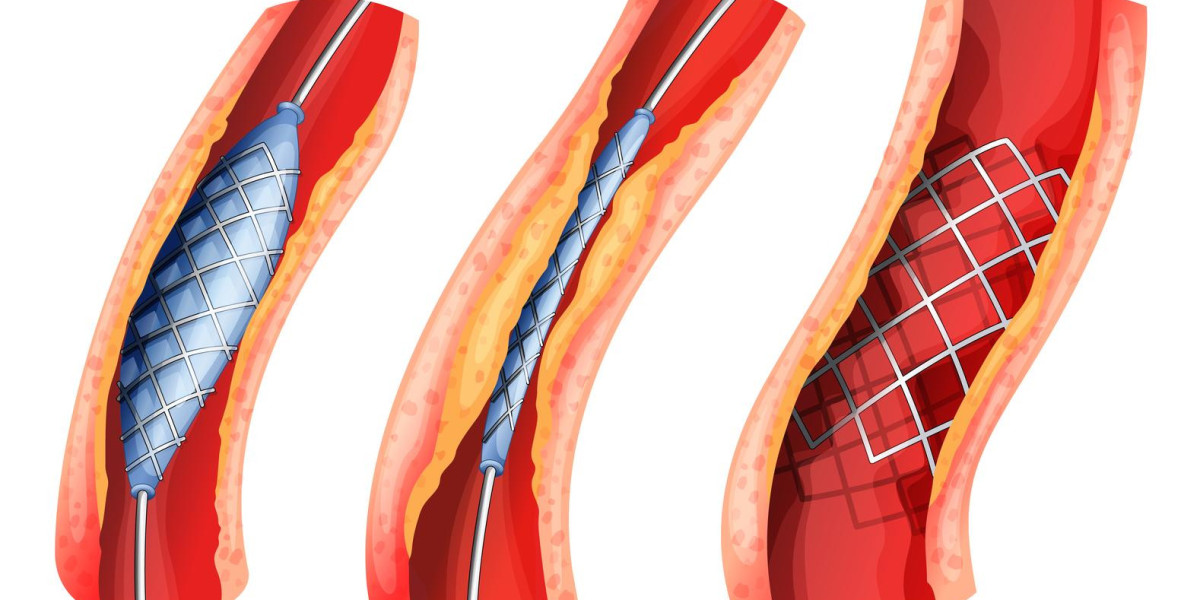 Vascular Embolization Market Size, Trends, and Strategic Outlook 2025-2032