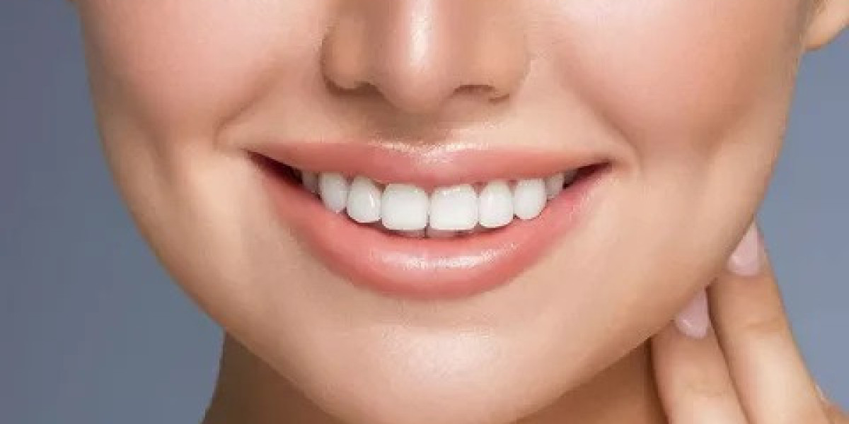 Can Everyone Get Dental Veneers?