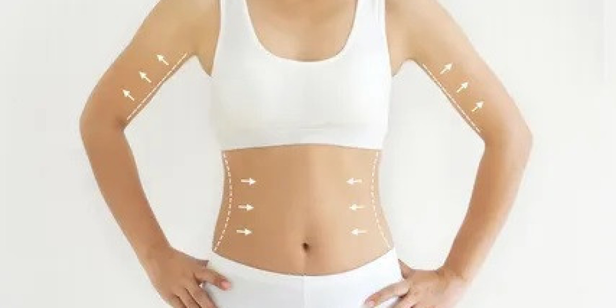 Body Contouring in Islamabad vs Liposuction: Key Differences