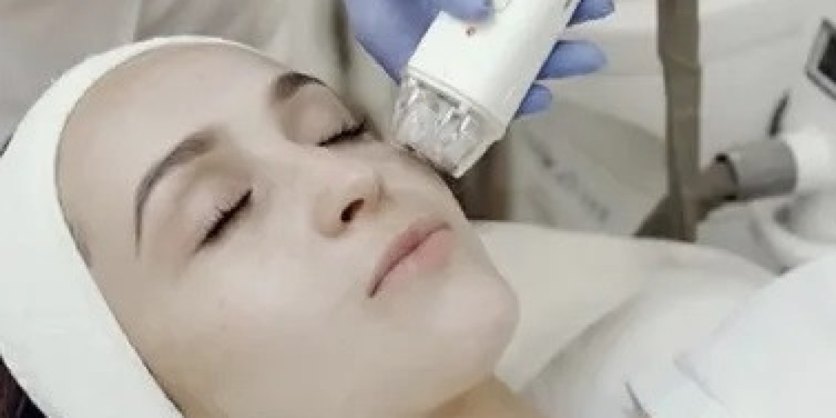 Timeline of Results: Melasma Treatment in Islamabad