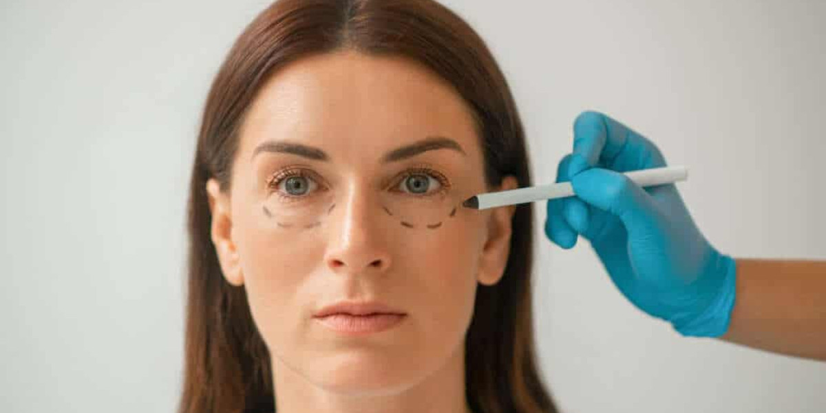 What Patients Say About Dark Circles Treatment in Islamabad