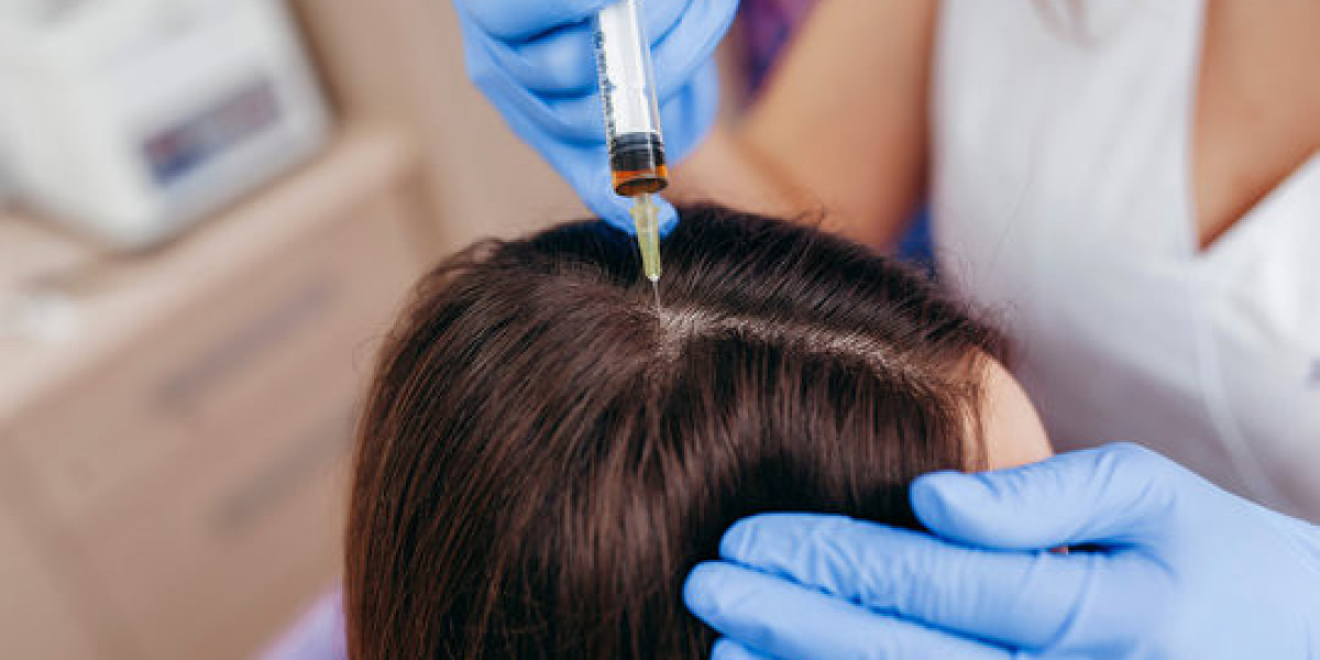PRP Hair Therapy Cost in Islamabad: What to Expect