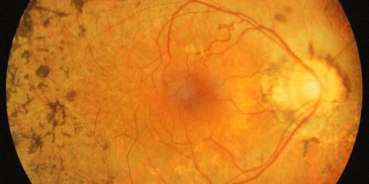 Retinis Pigmentosa Market Dynamics: Size, Trends, and Strategic Insights
