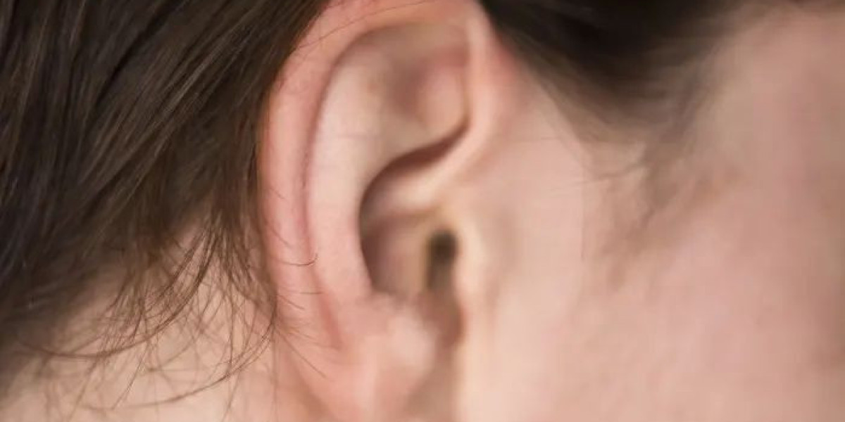 Ear Reshaping Surgery Benefits Riyadh