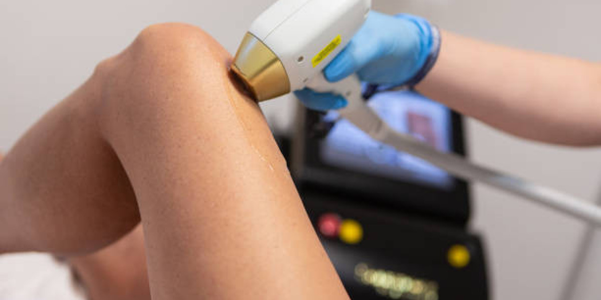 Effortless Hair Removal in Riyadh