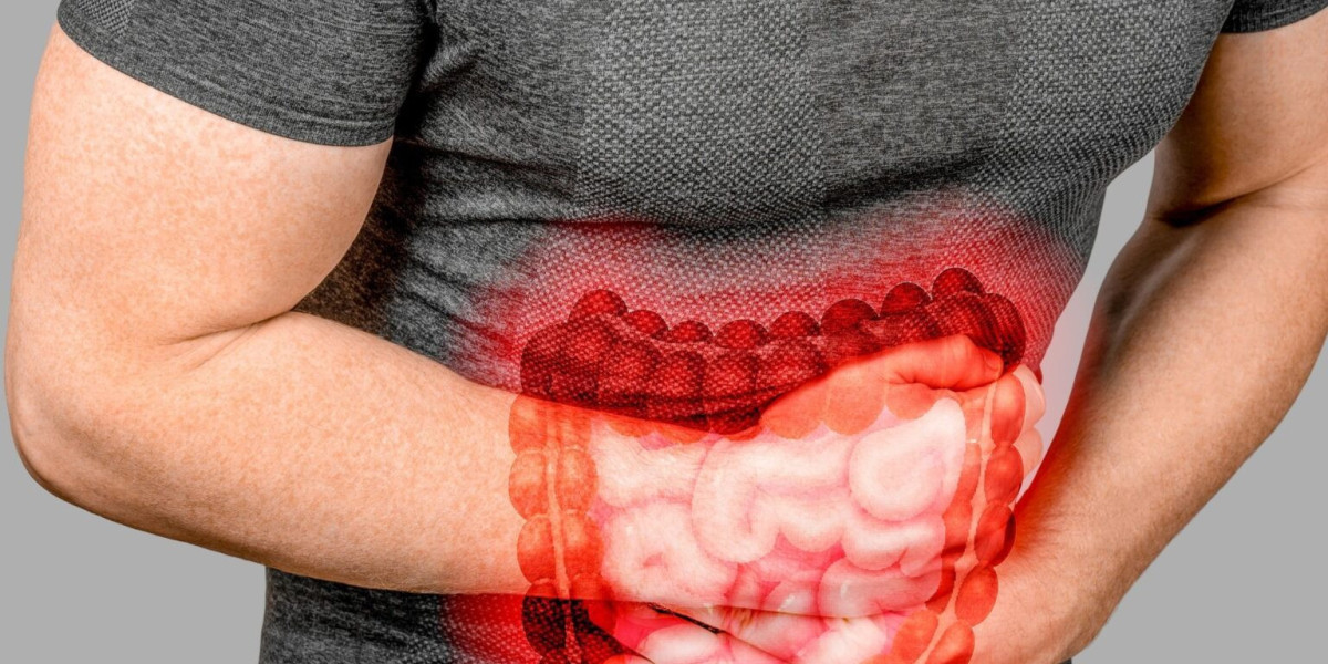 Regional Insights: North America Leads the Irritable Bowel Syndrome Treatment Market