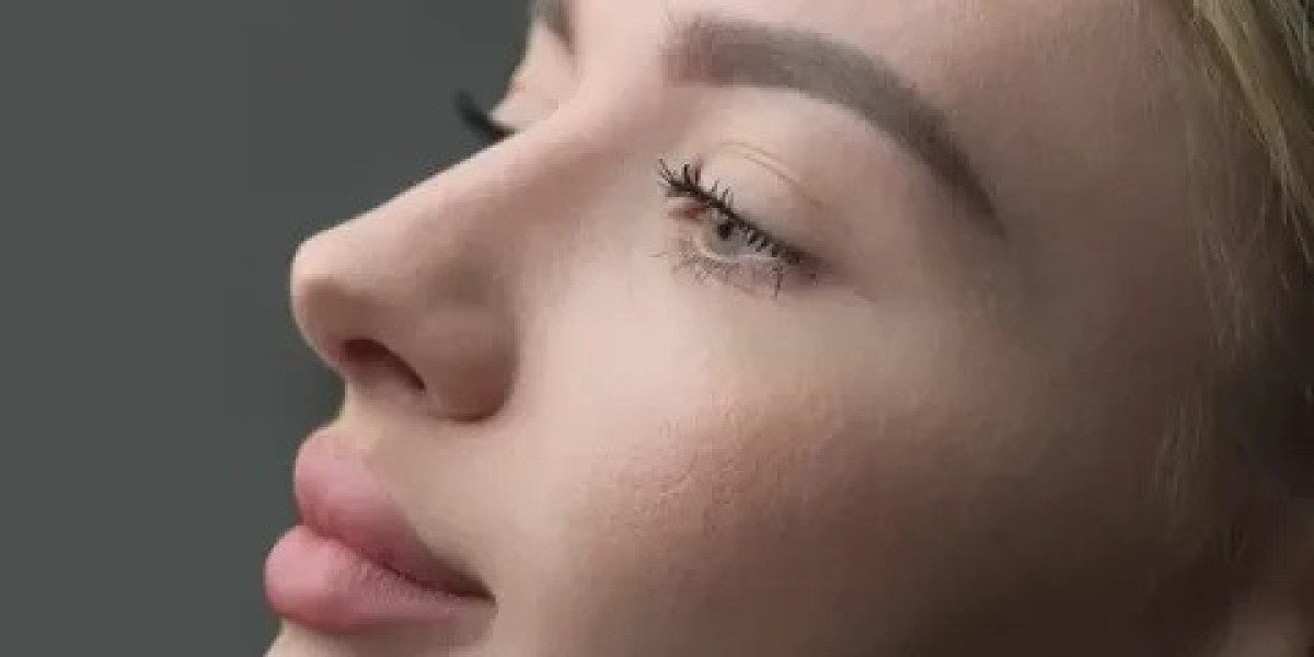 Rhinoplasty in Islamabad: Pre-Operative Guidelines