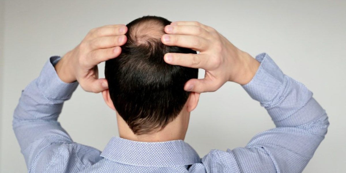 PRP Hair Care Experts Riyadh