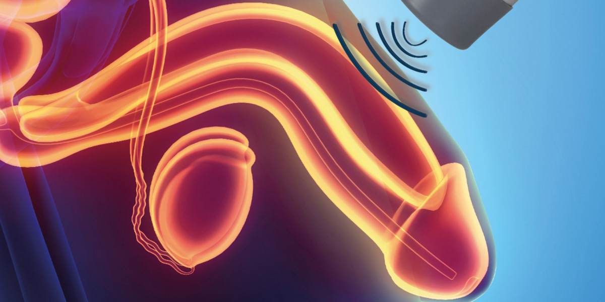 Digital Health Integration Driving Change in Erectile Dysfunction Devices Market