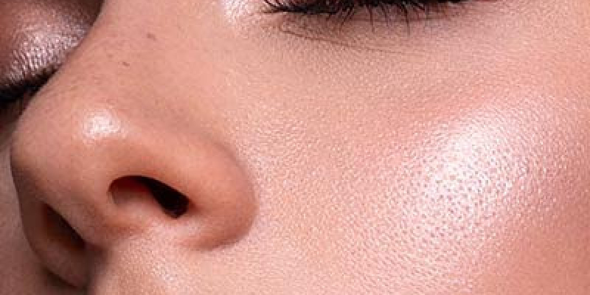 Alarplasty for Subtle vs. Dramatic Results in Islamabad