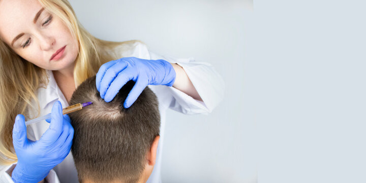 Hair Loss Treatment in Islamabad: Top Tips for Recovery