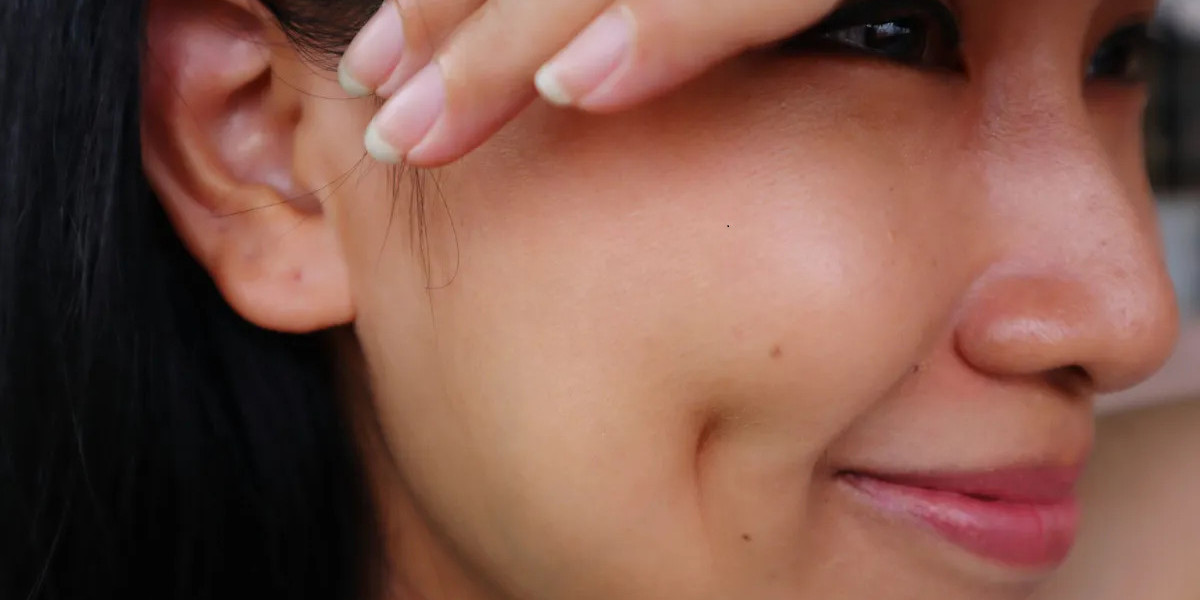 How Long Does It Take for Dimples to Look Natural?