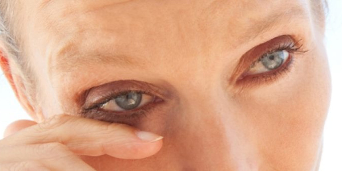 Competitive Landscape of the Dry Eye Disease Market: Key Players & Strategies