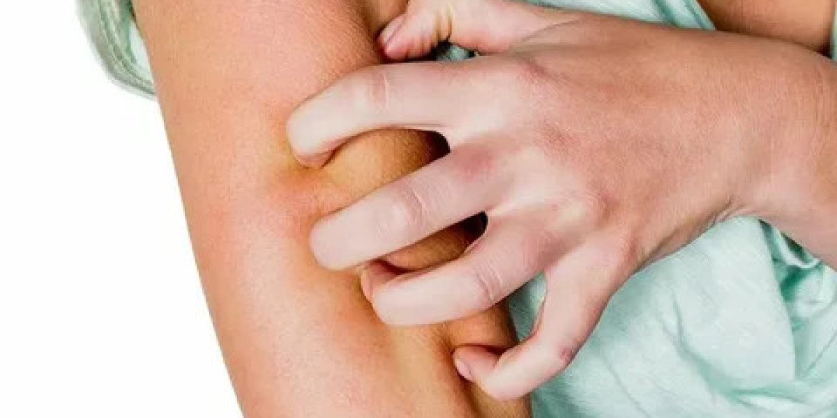 Plaque Psoriasis Market Size, Trends, and Strategic Outlook 2025-2032
