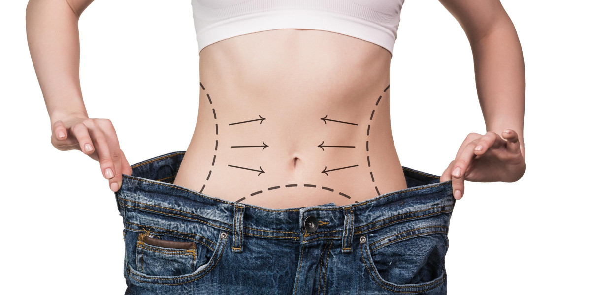 What Is the Recovery Time for a Tummy Tuck in Islamabad?