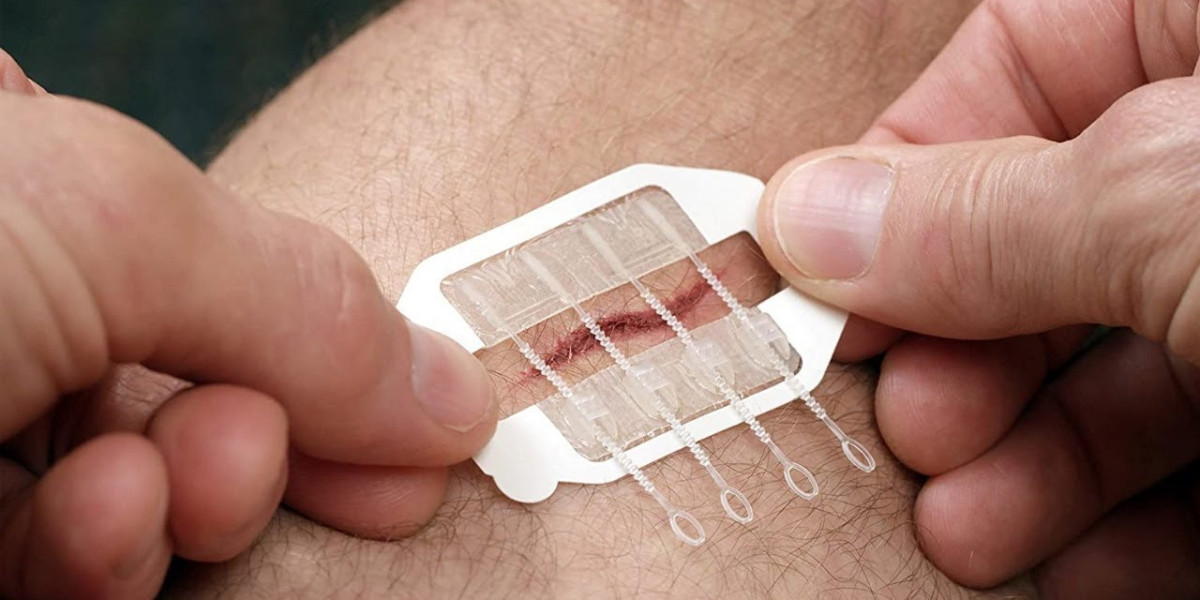 Emerging Technologies Driving the Wound Closure Market Growth
